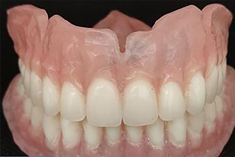 sugarland before and after dental treatment