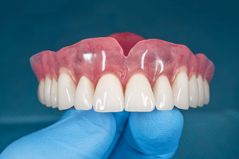 denture model